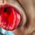 Angina: objawy, przyczyny i skuteczne leczenie infekcji